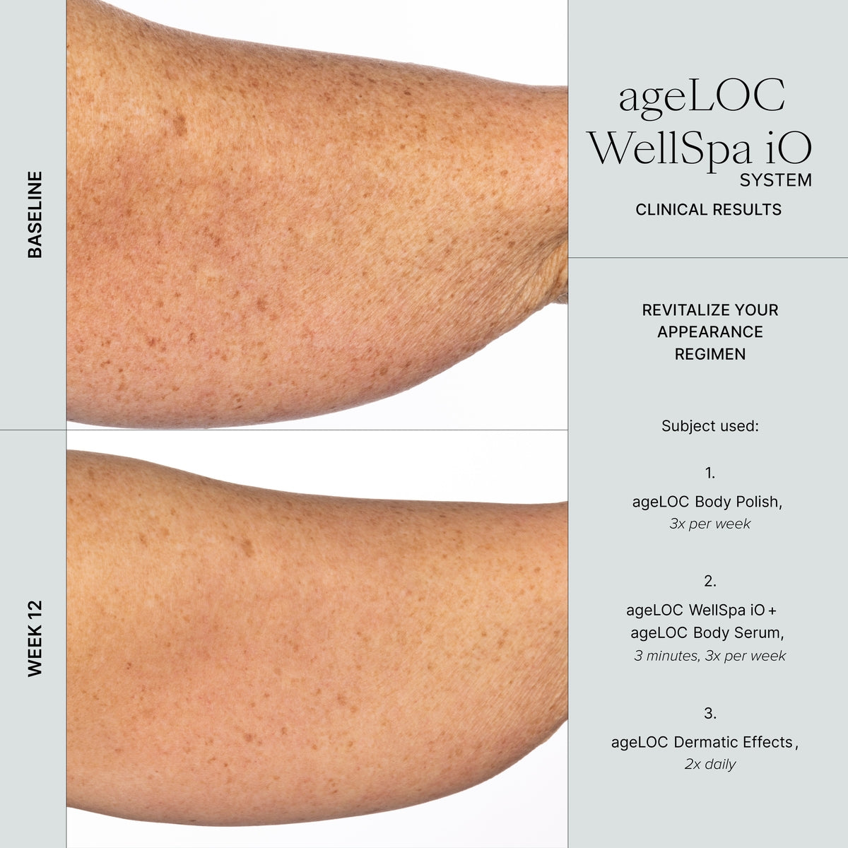 WellSpa iO before after