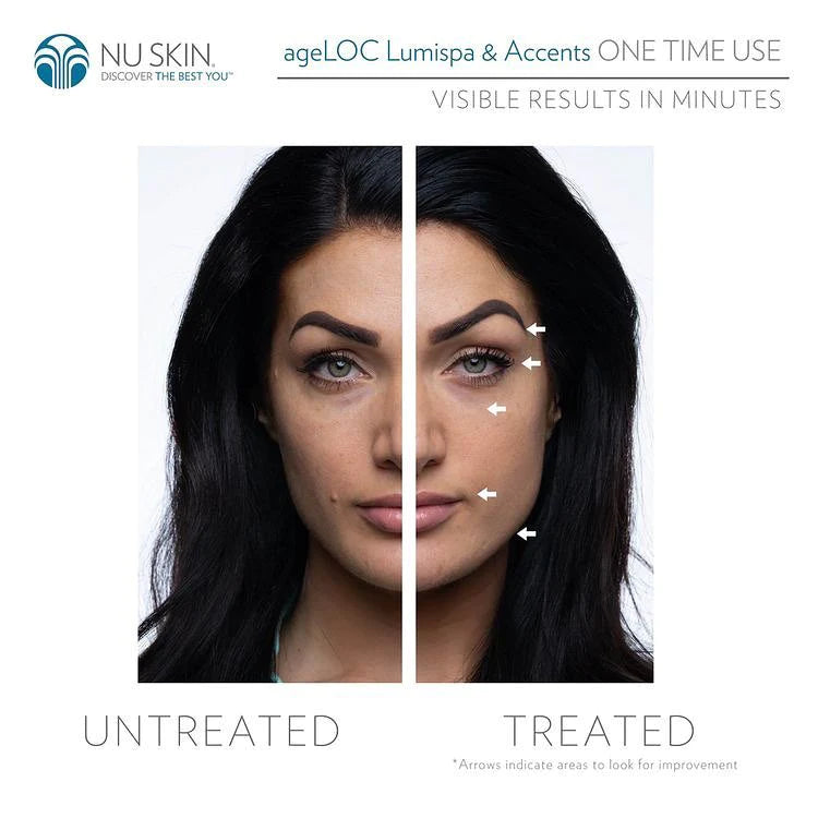 Before - after photo - LumiSpa Accent eye care