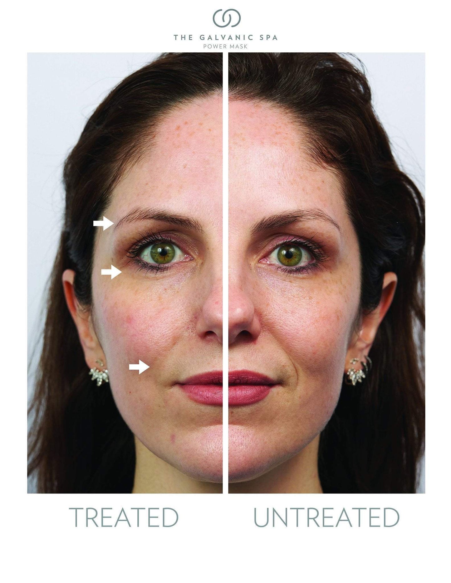 Two halves of a woman's face treated and untreated with Galvanic Spa